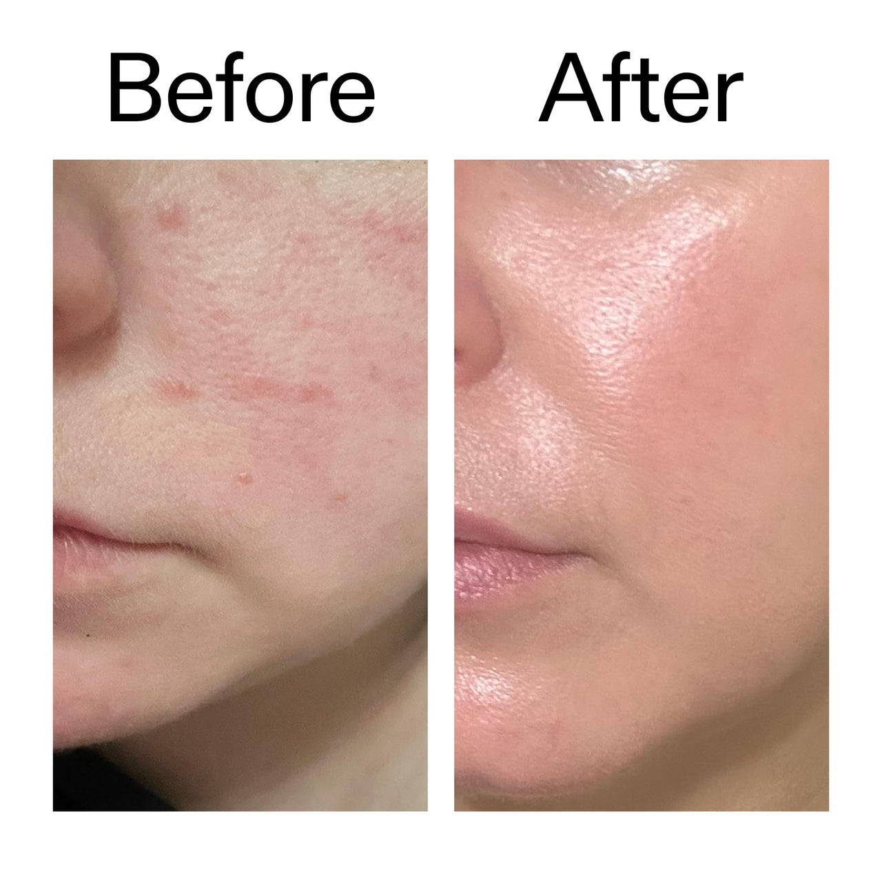 The INKEY List Exosome Hydro-Glow Complex, Enhances Skin Radiance, Rejuvanating Skincare, Advanced Hydration, Suitable For All Skin Types