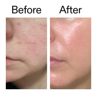Thumbnail for The INKEY List Exosome Hydro-Glow Complex, Enhances Skin Radiance, Rejuvanating Skincare, Advanced Hydration, Suitable For All Skin Types