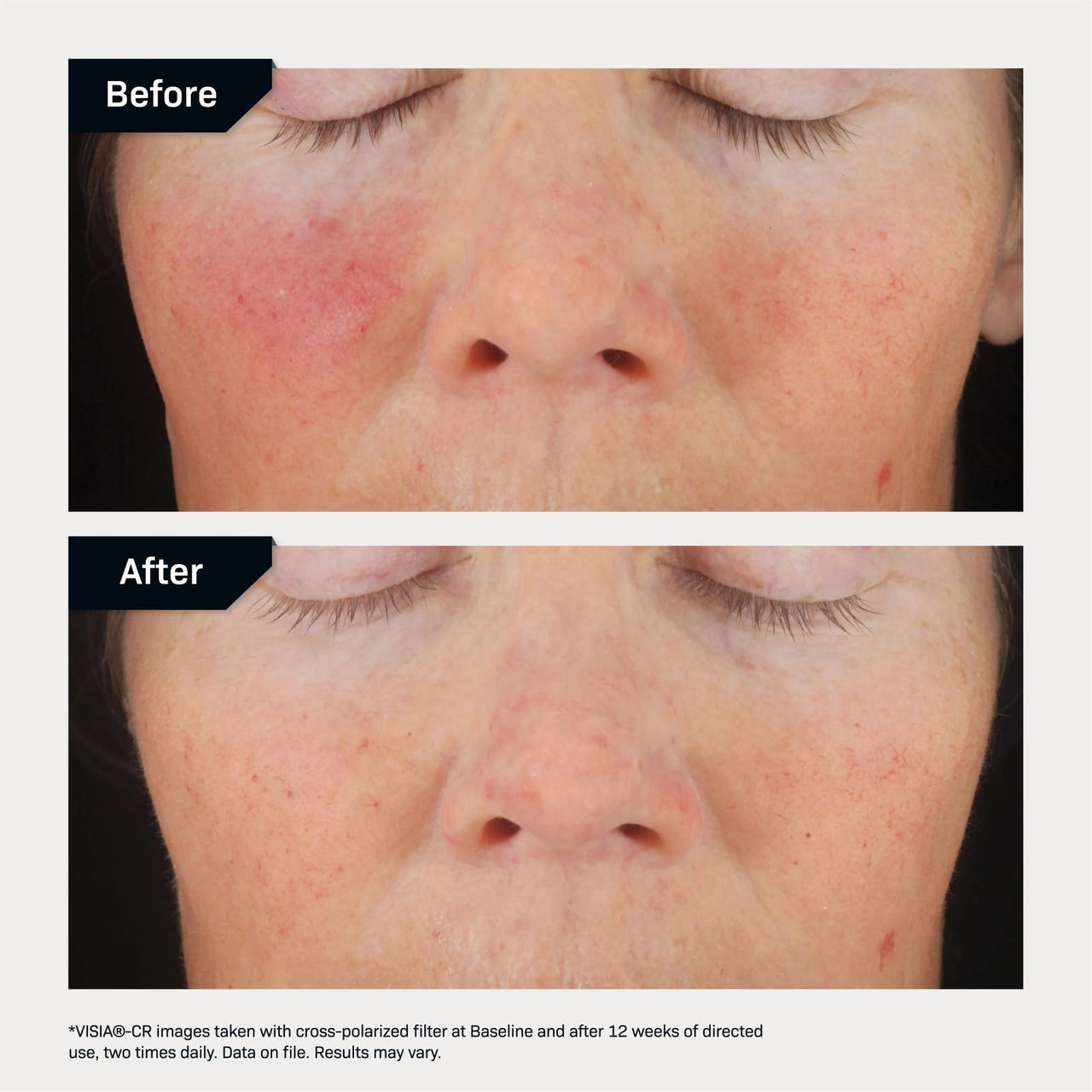 Revision Skincare C+ Correcting Complex 30%®, Anti Aging Antioxidant Blend with Vitamin C, Supports Healthy Skin, 0.5 fl oz