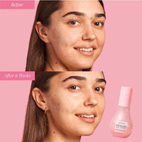 Thumbnail for Glow Recipe Watermelon Niacinamide Dew Drops, Korean Niacinamide Serum Drops, Hydrating Face Serum + Primer & Liquid Highlighter, Hyaluronic Acid, Dewy Glow (40ml)