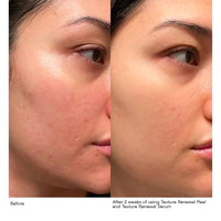 Thumbnail for Dr. Dennis Gross Advanced Retinol + Ferulic Texture Renewal Serum – Anti-Aging Formula to Smooth Texture, Boost Radiance, and Minimize Fine Lines & Wrinkles, 1 oz