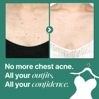 Thumbnail for SOME BY MI AHA BHA PHA 30 Days Miracle Acne Clear Body Cleanser – Pack of 2 – Daily Exfoliating Tea Tree & Salicylic Acid Acne Body Wash – Deep Cleanses Sebum, Oil & Impurities – Korean Skin Care