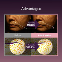 Thumbnail for Collagen Peptide 12X Boosting Serum, Enhances Skin Elasticity & Reduces Deep Wrinkles, Promotes Collagen Production for Firm and Youthful Skin, Korean Skincare, 1.01 fl.oz
