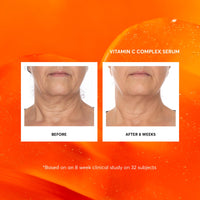 Thumbnail for Naturium Vitamin C Complex Face Serum Jumbo, Anti-Aging Facial Treatment with Hyaluronic Acid & Vitamin E, 2 oz