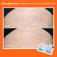 Thumbnail for Dr. Dennis Gross Alpha Beta Ultra Gentle Daily Peel: for Dehydrated or Sensitive Skin, Uneven Tone or Texture, Fine Lines or Enlarged Pores (5 Treatments)