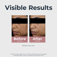 Thumbnail for Eucerin Radiant Tone Dual Serum Dark Spot Corrector, Dark Spot Serum with Thiamidol and Hyaluronic Acid, Helps Visibly Reduce the Look of Persistent Dark Spots, 1 Fl Oz Bottle