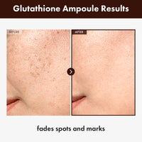 Thumbnail for TOSOWOONG Glutathione Serum with 20,000ppm Glutathione, Niacinamide and hyaluronic acid, Dark Spot, Improve skin elasticity, Revitalize complexion, Korean Skincare, 30ml, 1.01 fl. oz.