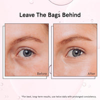 Thumbnail for grace & stella Under Eye Brightener Roller - Airplane Travel Essentials - Travel Size Toiletries - Retinol & Caffeine Eye Serum for Puffiness, Dark Circles, Wrinkles - Vegan Skincare (15ml / 0.51floz)