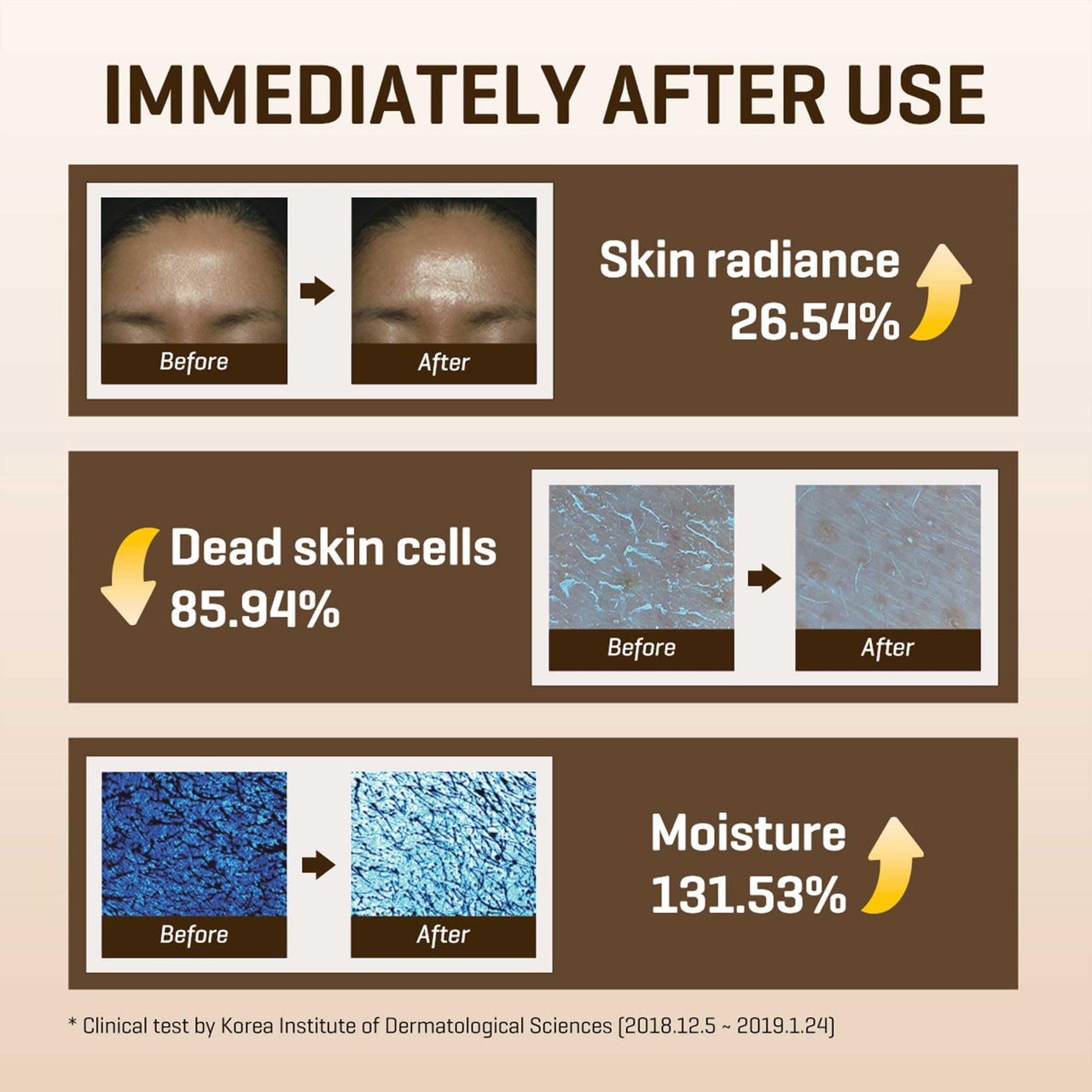 SOME BY MI Galactomyces Pure Vitamin C Glow Toner - 6.76Oz, 200ml - Korean Daily Vitamin C Face Toner for Skin Brightening - Glass Skin Routine with Skin Texture, Elasticity Care - Korean Skin Care