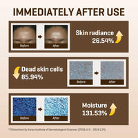 Thumbnail for SOME BY MI Galactomyces Pure Vitamin C Glow Toner - 6.76Oz, 200ml - Korean Daily Vitamin C Face Toner for Skin Brightening - Glass Skin Routine with Skin Texture, Elasticity Care - Korean Skin Care