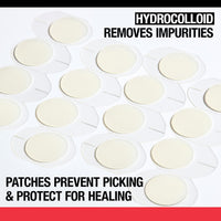 Thumbnail for Neutrogena Stubborn Acne Ultra-Thin Patches for Acne-Prone Skin - Hydrocolloid Overnight Blemish Patch for Clear Skin, 24 Patches