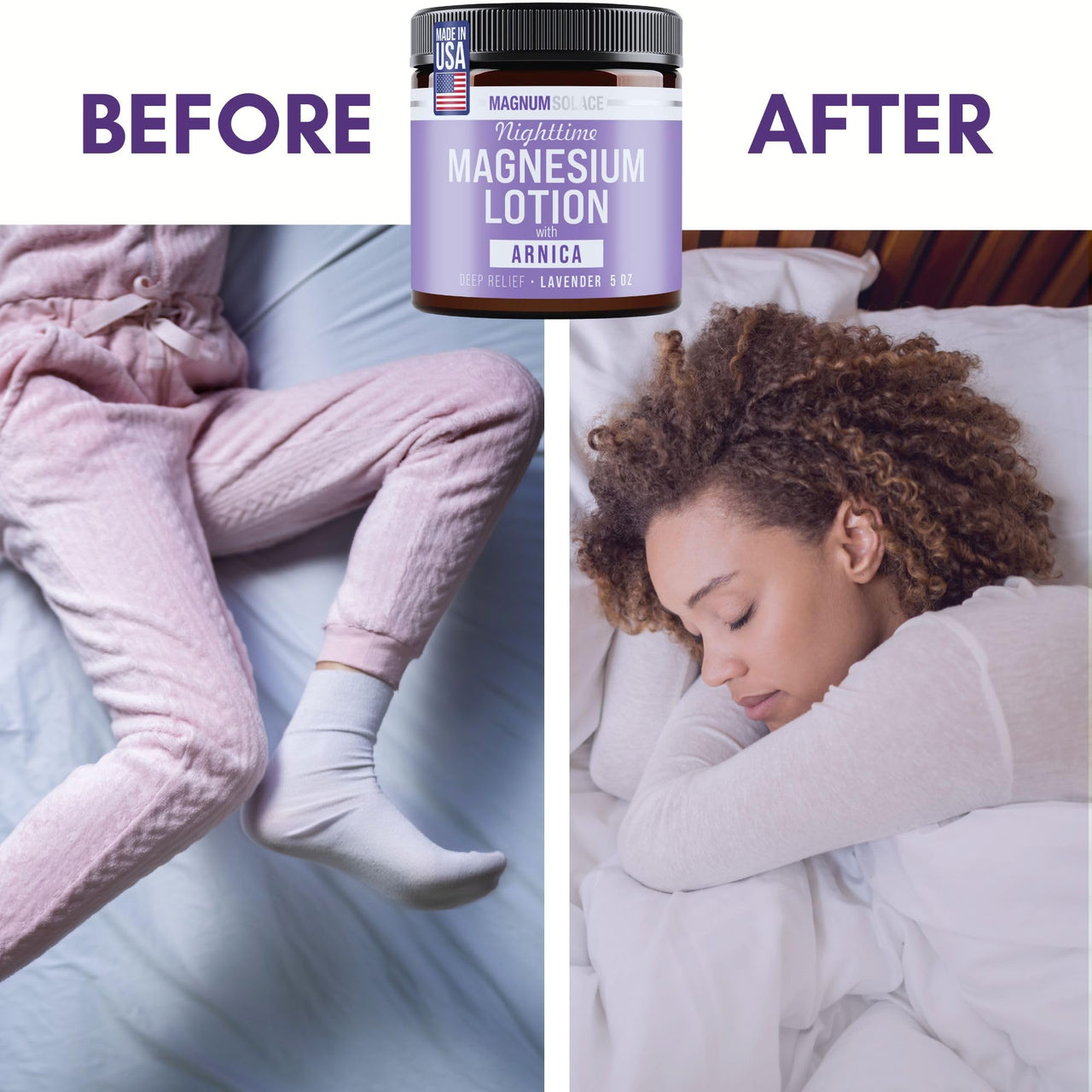 Magnum Solace Nighttime Magnesium Lotion with Arnica – Soothing Relief & Relaxation, Highly Concentrated Magnesium for Muscles & Joints – Apply to Legs or Feet Before Bed – Skin-Friendly
