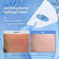 Thumbnail for BIODANCE Hydro Cera-nol Real Deep Mask, Hydrating Overnight Hydrogel Face Mask, Moisturizing, Redness Reducing, Quick Soothing, Korean Skin Care |1.19oz(34g) x4ea