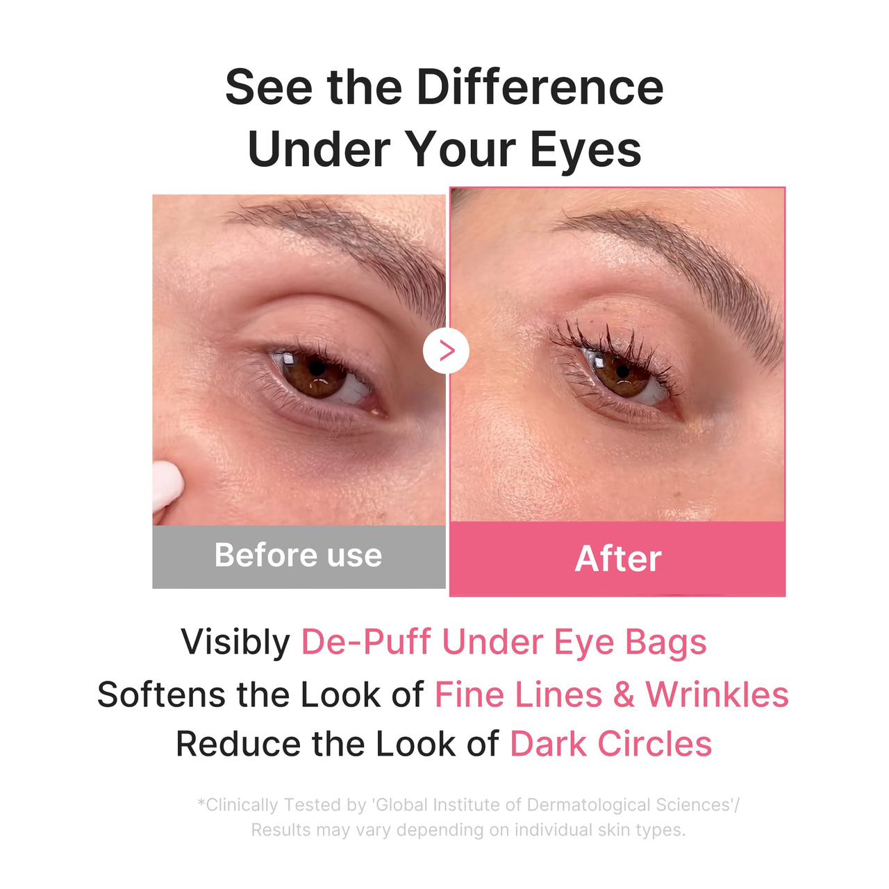 medicube Jelly Eye Mask PDRN Pink Collagen | Hydrogel Eye Patches with PDRN, Collagen, NAD | Refreshing for Puffy, Tired Eyes | Firming for Look of Wrinkles, Fine Lines | Korean Skincare (28 Pairs)