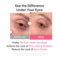 Thumbnail for medicube Jelly Eye Mask PDRN Pink Collagen | Hydrogel Eye Patches with PDRN, Collagen, NAD | Refreshing for Puffy, Tired Eyes | Firming for Look of Wrinkles, Fine Lines | Korean Skincare (28 Pairs)