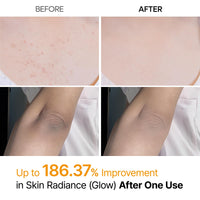 Thumbnail for Dr.Melaxin Body Keratin Care Kojic Acid Turmeric Spray Gently Exfoliating Peeling Solution Korean Skincare All Skin Types 200ml