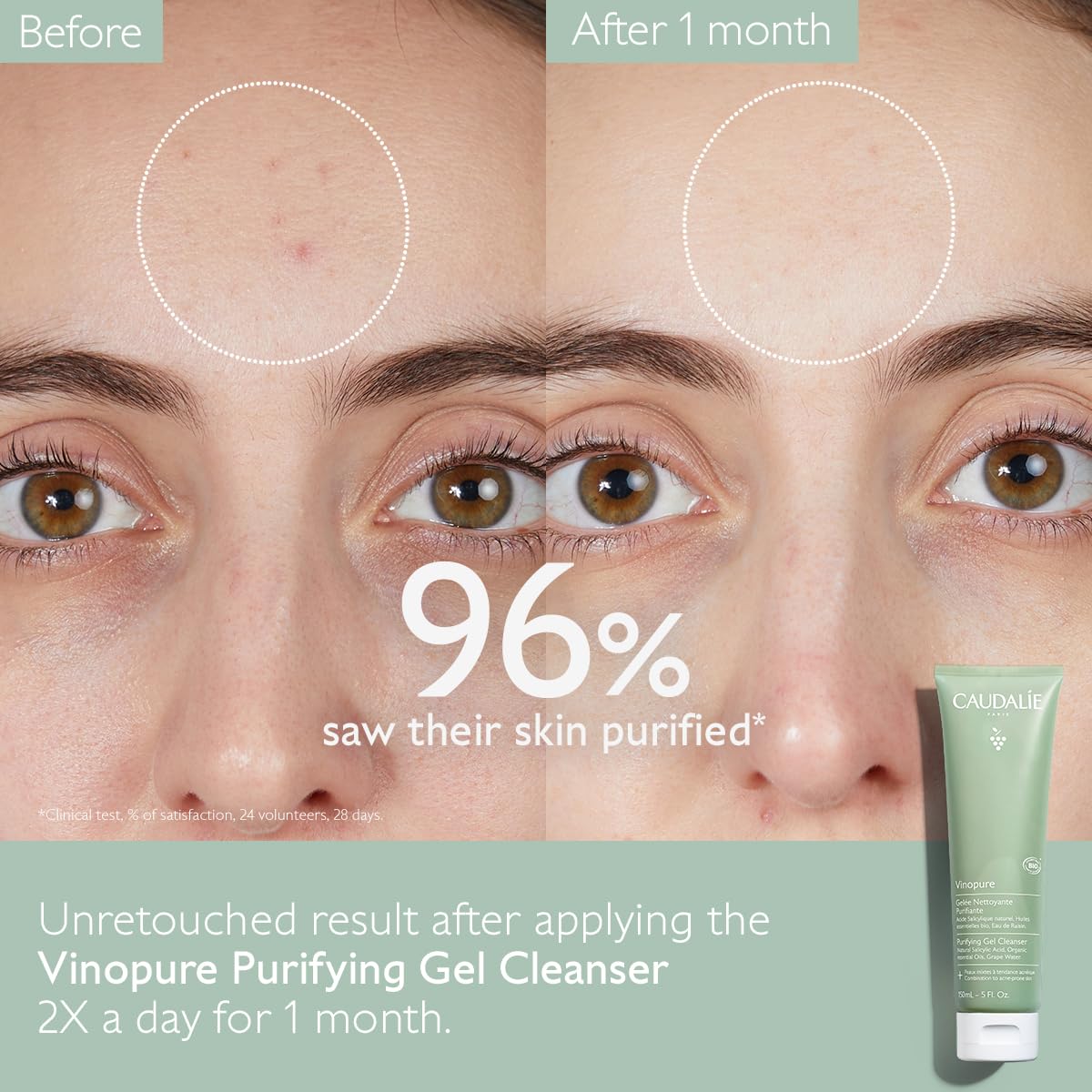 Caudalie Vinopure Salicylic Acid Cleanser, Pore Purifying Gel Cleanser - 150 mL