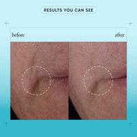 Thumbnail for philosophy dose of wisdom bouncy skin revitalizing serum 1 fl oz