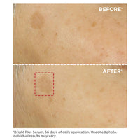 Thumbnail for Clarins Bright Plus Serum | Skin Has A Healthy-Looking Glow and Skin Tone Is Visibly Improved* | Visibly Brightens and Boosts Radiance | Targets Dark Spots | Acerola Extract, Rich In Vitamin C | 1 Oz