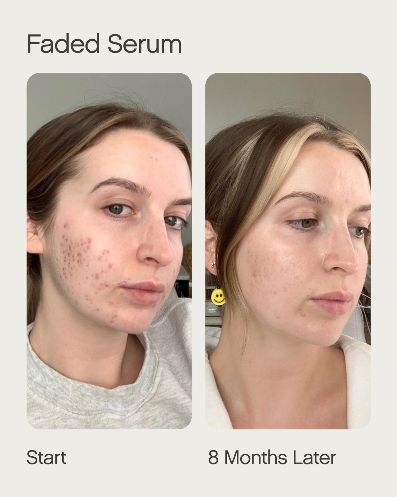 Dark circles, sun damage and pigmented skin? Get Faded Under Eye Masks + Faded Serum – a starter pack to experience our best-selling Faded formula for brightening and evening skin tone. Faded Eye Masks harness the same skin-brightening and evening ingredi