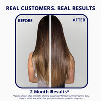 Thumbnail for Sugarbear Hair Vitamin Gummy 2 Month Supply Extra Strength Biotin 6000mcg, Growth for Men & Women, Vegan Vitamin B12, MSM, Inositol, Omega 3, Elderberry, Certified Kosher, Halal, Cruelty-Free