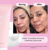 Thumbnail for Saturday Skin Hydrating Foam Cleanser – Anti Aging Face Wash with Apple Extract, Moisturizing Face Wash, All Natural Foaming Facial Cleanser, Korean Face Wash for Women & Sensitive Dry Skin