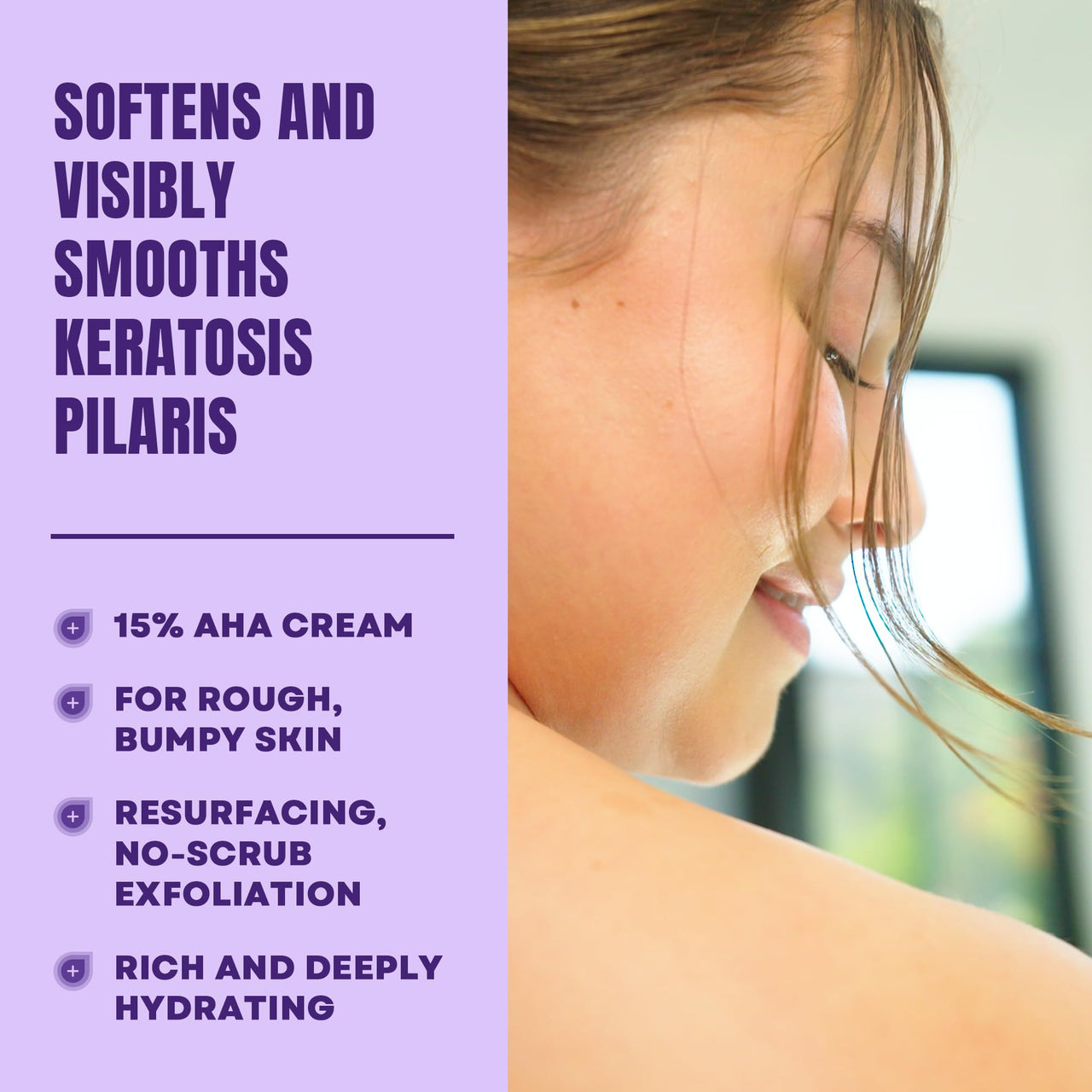 AmLactin KP Bumps Be Gone - Therapeutic Body Cream for Keratosis Pilaris - No-Scrub Exfoliator and Moisturizer with 15% Lactic Acid AHA, 3 oz (Packaging May Vary)