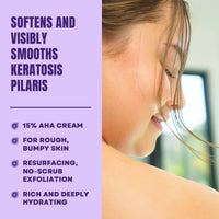 Thumbnail for AmLactin KP Bumps Be Gone - Therapeutic Body Cream for Keratosis Pilaris - No-Scrub Exfoliator and Moisturizer with 15% Lactic Acid AHA, 3 oz (Packaging May Vary)