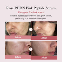 Thumbnail for medicube PDRN Pink Peptide Serum, Pink glow serum, Peptide, Niacinamide, Hydrating & Moisturizing & Firming, Uneven Skin Tone, Korean Skincare | 1.01 fl.oz. (1.01 fl.oz., Rose PDRN (Vegan))