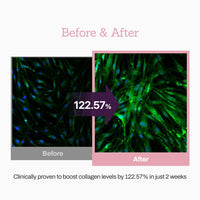 Thumbnail for Collagen Peptide 12X Boosting Serum, Enhances Skin Elasticity & Reduces Deep Wrinkles, Promotes Collagen Production for Firm and Youthful Skin, Korean Skincare, 1.01 fl.oz