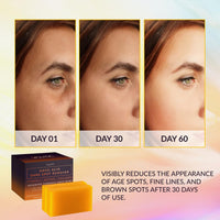 Thumbnail for VALITIC Kojic Acid Dark Spot Remover Soap Bars with Vitamin C, Retinol, Collagen, Turmeric - Original Japanese Complex Infused with Hyaluronic Acid, Vitamin E, Shea Butter, Castile Olive Oil (2 Pack)