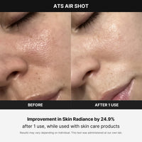 Thumbnail for Medicube Age-R ATS Air Shot - Microneedling Pore Tightening Skin Care Device for Enhanced Absorption, Pore Refinement, and Smoother Skin Texture - Exfoliation, Skin Rejuvenation - Korean Skin Care