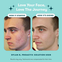 Thumbnail for Proactiv 3 Step Acne Treatment w/ Pimple Patches - Benzoyl Peroxide Face Wash, Repairing Acne Spot Treatment for Face and Body, Exfoliating Toner - 90 Day Complete Acne Skin Care Kit + Pimple Patches