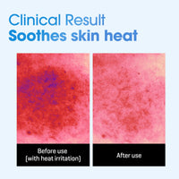Thumbnail for SOME BY MI Beta-Panthenol Repair Daily Mask - 30 Sheets, 11.8Oz - Daily Vegan Korean Face Sheet Mask for Skin Barrier Recovery - Hydrating and Moisturizing Skin Care with Panthenol - Korean Skin Care
