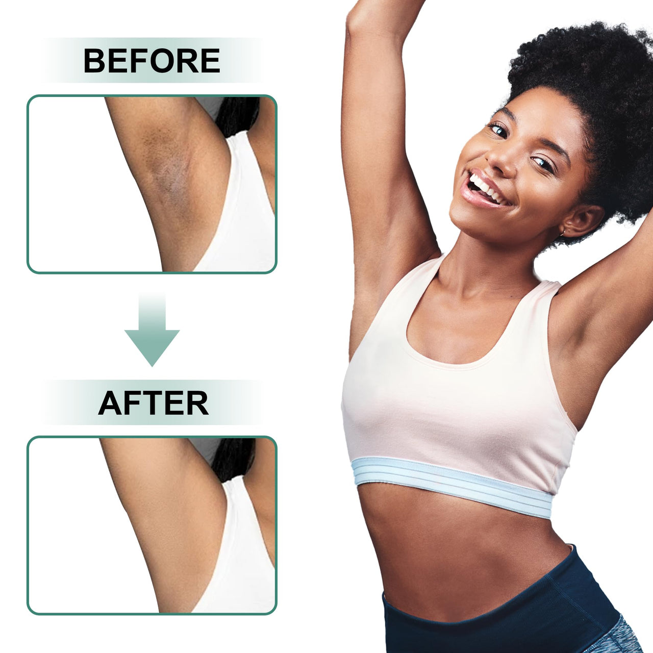 Vcetree Skin Bleaching Cream Skin Lightening for Body Intimate Areas, Private Parts, Underarm, Knees, Elbows, Inner Thigh, Bikini Area, Whitening Cream Dark Spot Remover For Intimate Areas (1FL OZ)