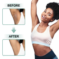 Thumbnail for Vcetree Skin Bleaching Cream Skin Lightening for Body Intimate Areas, Private Parts, Underarm, Knees, Elbows, Inner Thigh, Bikini Area, Whitening Cream Dark Spot Remover For Intimate Areas (1FL OZ)