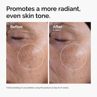 Thumbnail for The Ordinary Glycolic Acid 7% Exfoliating Toner, Brightening and Smoothing Daily Toner for More Even-Looking Skin Tone, 8.1 Fl Oz