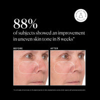 Thumbnail for Naturium Vitamin C Super Serum Plus, Smoothing Face Care, plus Retinol, Hyaluronic Acid, Niacinamide & Salicylic Acid, 1 oz