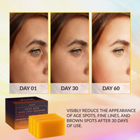 Thumbnail for VALITIC Kojic Acid Dark Spot Remover Soap Bars with Vitamin C, Retinol, Collagen, Turmeric - Original Japanese Complex Infused with Hyaluronic Acid, Vitamin E, Shea Butter, Castile Olive Oil (3 Pack)