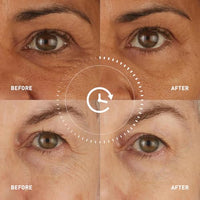 Thumbnail for Image 8 of skyn ICELAND Hydro Cool Firming Eye Patches with Peptides and Coenzyme Q10