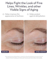 Thumbnail for Image 3 of ALASTIN Skincare Renewal Retinol Serum (.5 Strength, 1.0 oz)