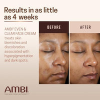 Thumbnail for Image 4 of Ambi Even & Clear Fade Cream, 1 Fl Oz