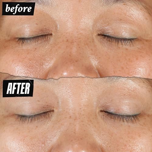 Image 7 of Kiehl's Clearly Corrective Dark Spot Solution Brightening Serum