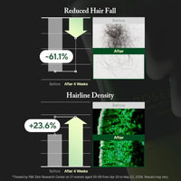Thumbnail for Image 6 of AROMATICA Overnight Rosemary PDRN Scalp Serum for Scalp Treatment