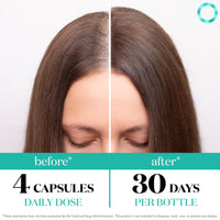 Thumbnail for Women's Balance Hair Growth Supplements, Ages 45 and Up, Customer Proven for Visibly Thicker Hair and Scalp Coverage, Soy-Free, Made with 26 Ingredients including Beta Carotenes - 2 Month Supply