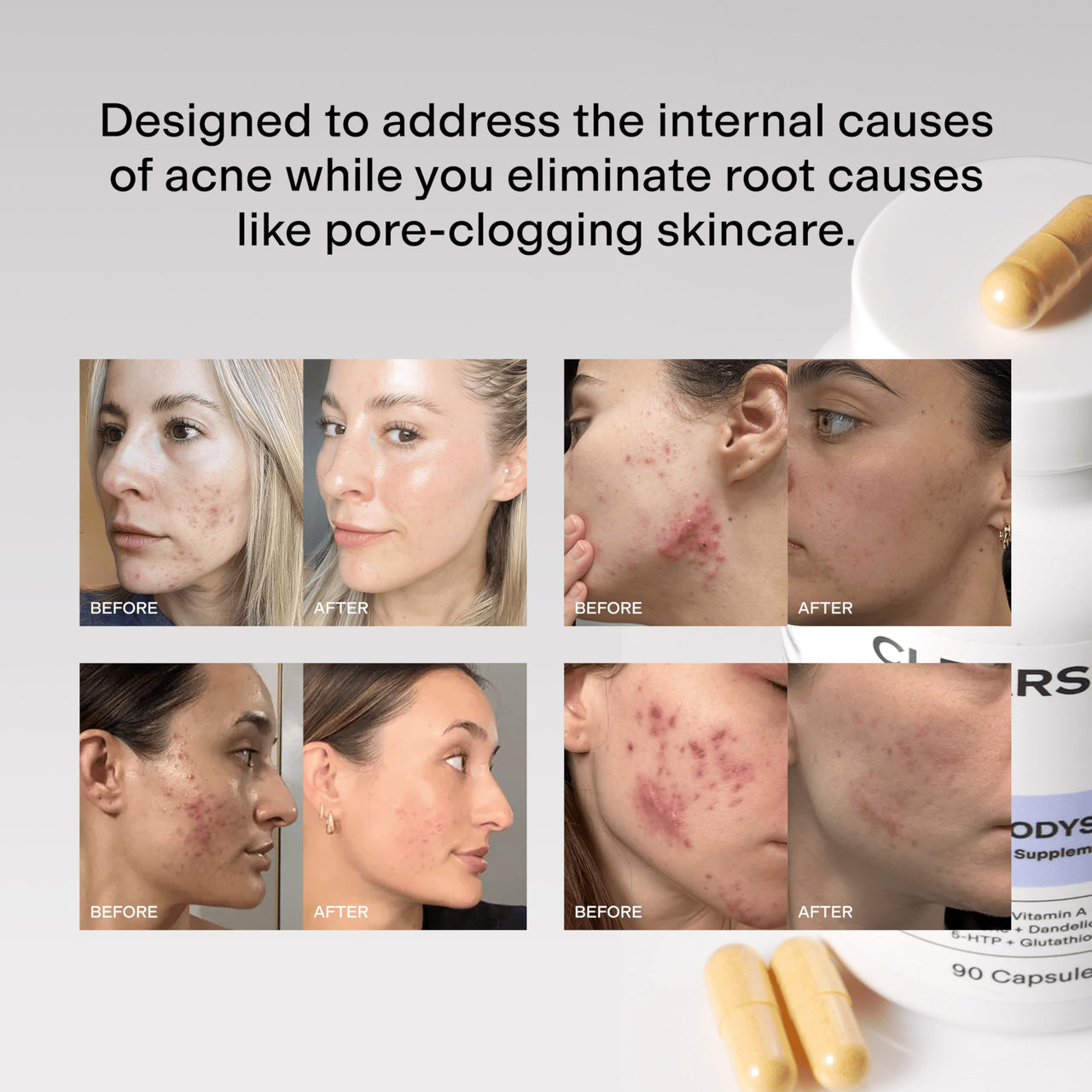 CLEARSTEM - MINDBODYSKIN Hormonal Acne Supplement (5-HTP) - Natural DIM Supplement - Skin Care Vitamins - Hormone Balance, Antioxidants - Gluten Free, Cruelty Free - 30 Servings, 90 Capsules
