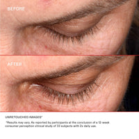 Thumbnail for Olaplex Lashbond Building Serum: Clear Eyelash Enhancing Serum | Natural, Longer, Healthier, Thicker, Fuller-Looking Lashes | Daily Use, Results in Little as 2 Weeks, 4.5 mL / 0.15 Fl Oz