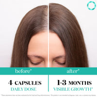 Thumbnail for Women's Balance Hair Growth Supplements, Ages 45 and Up, Customer Proven for Visibly Thicker Hair and Scalp Coverage, Soy-Free, Made with 26 Ingredients Including Beta Carotenes - 1 Month Supply