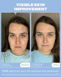 Thumbnail for Then I Met You Renewing Rich Beauty Cream, Deep Hydration Korean Moisturizer with Quad Ginseng Complex, Fast Absorbing Vegan-Cruelty-Free Plant-Based Antioxidant, Alcohol Free Skincare for Exfoliated