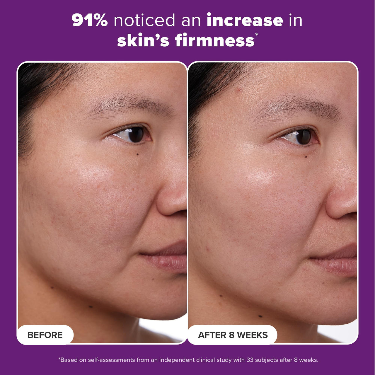 Paula's Choice CLINICAL 1% Retinol Face Treatment with Peptides, Vitamin C & Licorice Extract, Anti-Aging Skin Care Serum, Fine Lines & Wrinkles, Fragrance Free, 1 Fl Oz